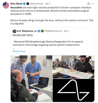 马斯克放出“量产时间表”，脑机接口集体涨停，商业化拐点来了？